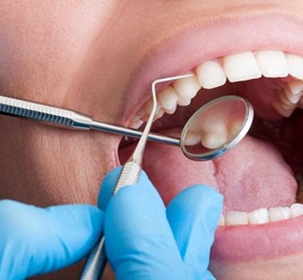 مراجعه به دندانپزشکی در دوران بارداری؛ آری یا خیر؟