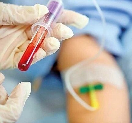 فوت ۲۶ بیمار هموفیلی به دلیل کمبودهای دارویی